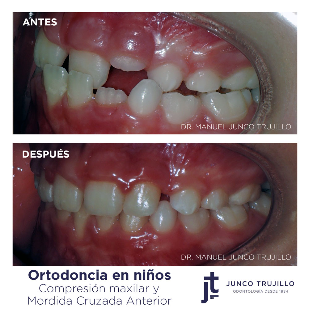 ortodoncia-brackets-en-palencia