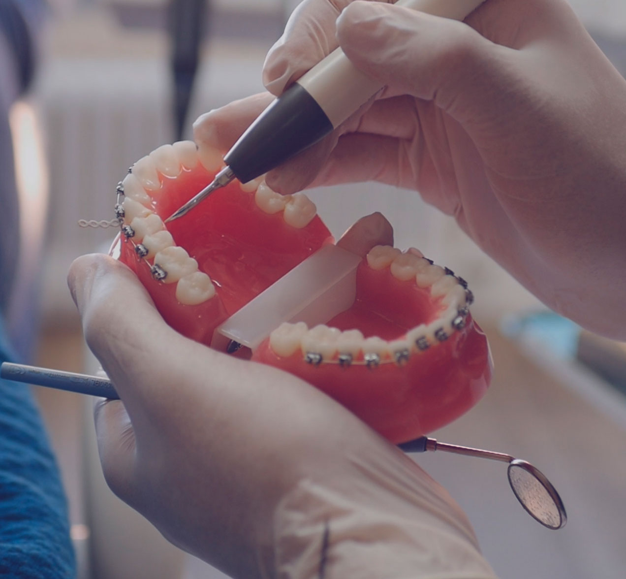 Ortodoncia-brackets-en-palencia